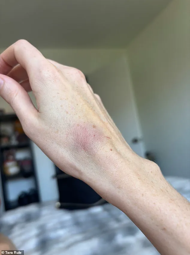 Breaking: TikTok Influencer with Disability Alleges Injury After American Airlines Refuses Assistance, Sparking Policy Debate