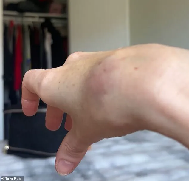 Breaking: TikTok Influencer with Disability Alleges Injury After American Airlines Refuses Assistance, Sparking Policy Debate