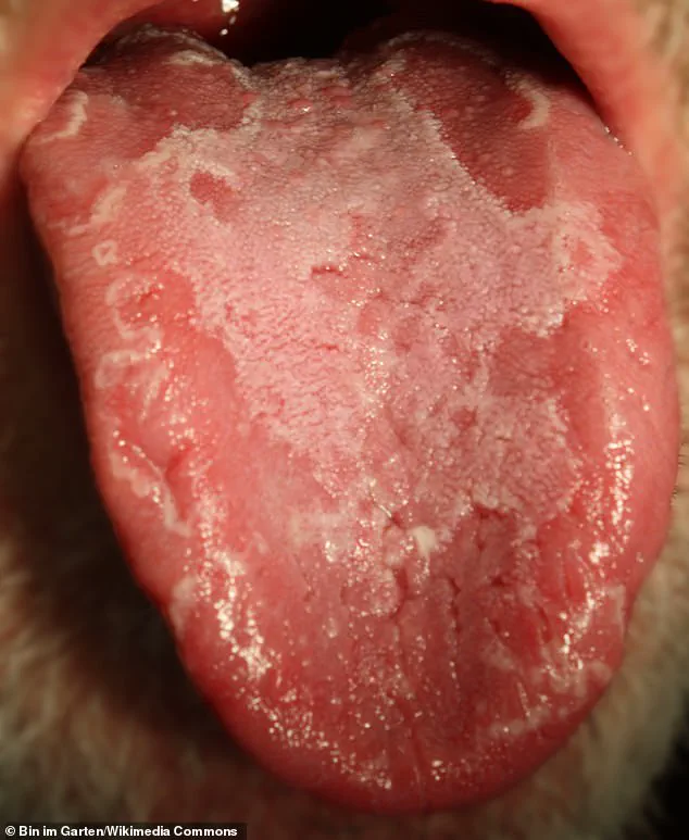 Kate McKinnon Opens Up About Living with Rare Condition Geographic Tongue