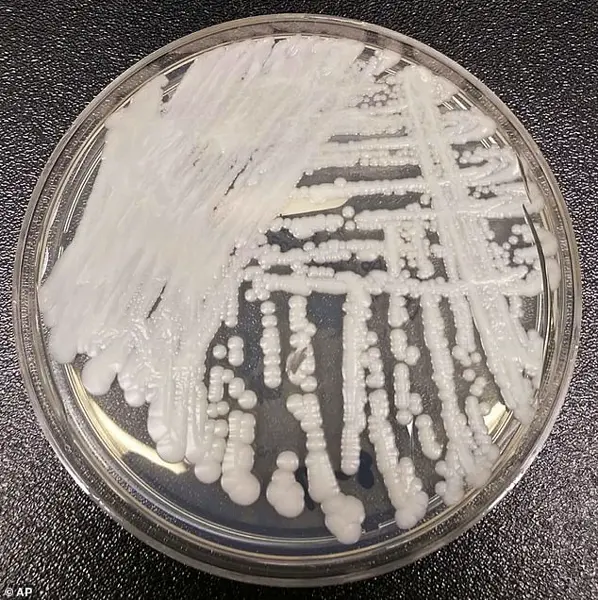 Rising Threat of Treatment-Resistant Candida Auris Sparks CDC Concerns as Infections Surge Across U.S. Hospitals