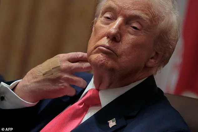 Trump's High-Calorie McDonald’s Meal Sparks Debate on Public Health Risks and Policy Contradictions