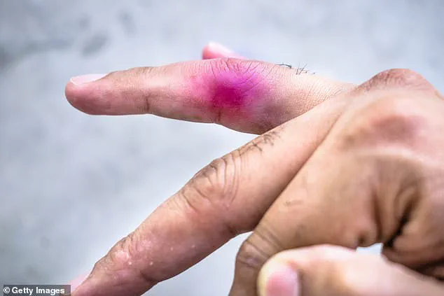 Nine-Year-Old Canadian Boy Sues 11-Year-Old Peer in Rare Legal Battle Over Toy Dinosaur Incident at Alberta Daycare