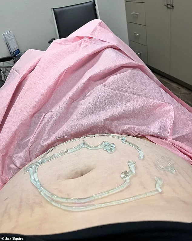 Texas Transgender Man's Adoption Decision Sparks Public Debate on Identity and Parental Rights