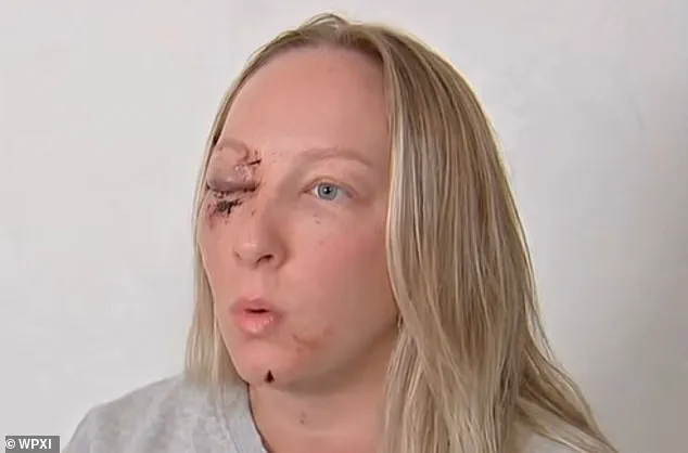 Ice Slab Shatters Windshield in Near-Fatal Pennsylvania Crash