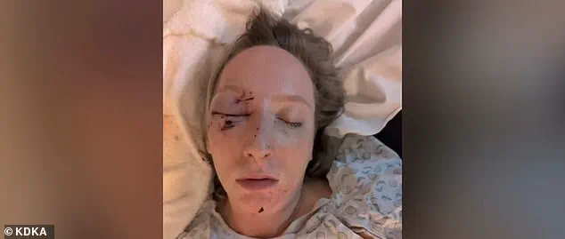 Ice Slab Shatters Windshield in Near-Fatal Pennsylvania Crash