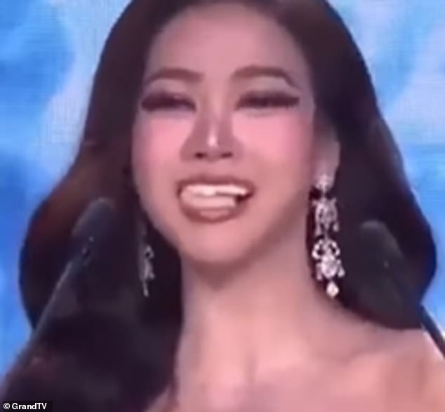 Thai Beauty Queen Turns Dental Drama into Moment of Grace at Miss Grand Thailand Pageant