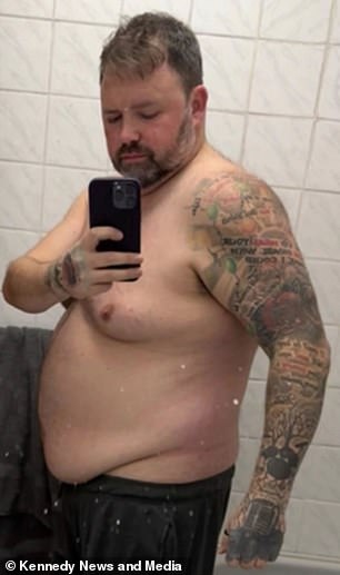 Father warns against weight-loss injections after severe infection nearly killed him