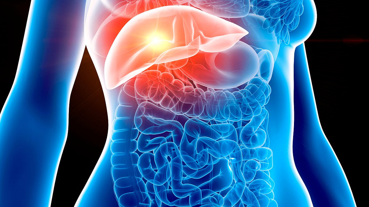 Experts Warn Specific Foods Drive Silent Surge in Fatty Liver Disease