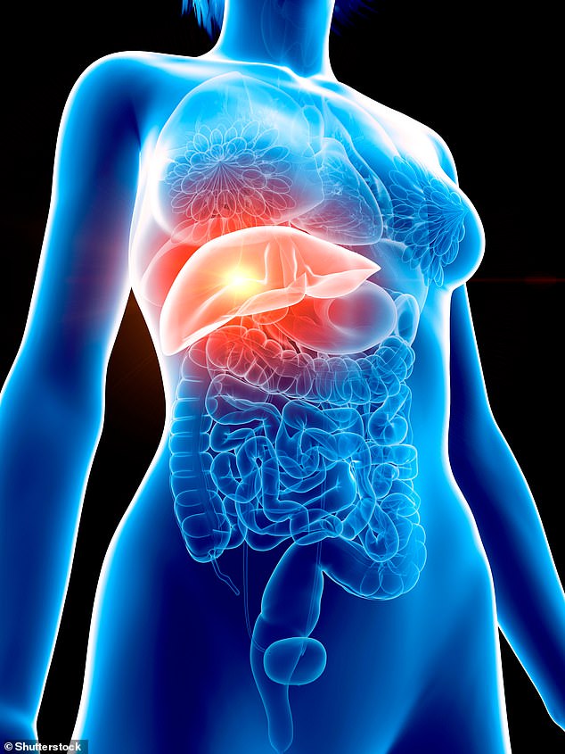 Experts Warn Specific Foods Drive Silent Surge in Fatty Liver Disease