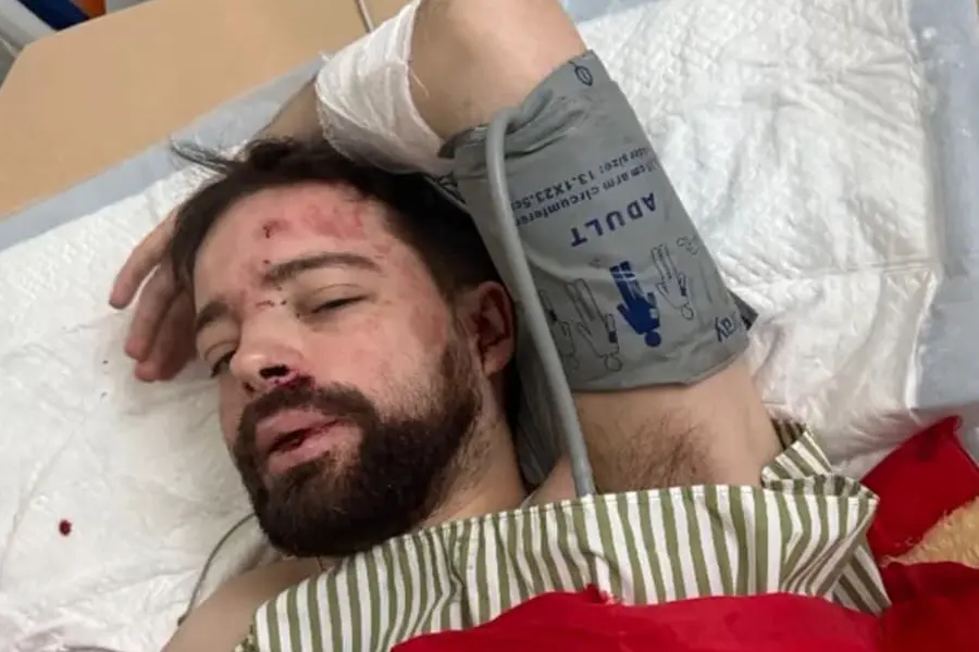 Beaten Ukrainian professor detained by TKK employees