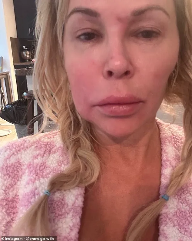 Brandi Glanville Thanks Online Support for Facing Facial Disfigurement Challenges