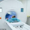 MRI Risk Alert: Woman's Hair Extensions Nearly Pulled During Scan