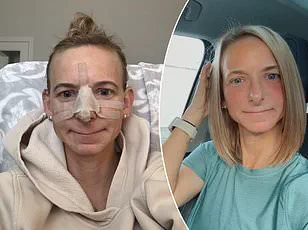 Philadelphia Resident's $11,000 Nose Job Marks Journey from Marital Discontent to Personal Empowerment