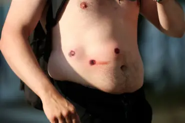 LAPD Escalates Protest Tactics with Rubber Bullets, Heightening Risks for Communities