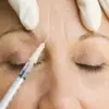 A Poisonous Paradox: How Government Regulation Turns Botulinum Toxin into a Popular Cosmetic