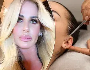 Exclusive Insights: The Untold Story of Maddison Steiner's Cosmetic Surgery Journey