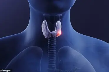Late-Breaking: Thyroid Cancer Symptoms Dismissed as Anxiety for Years