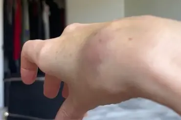 Breaking: TikTok Influencer with Disability Alleges Injury After American Airlines Refuses Assistance, Sparking Policy Debate