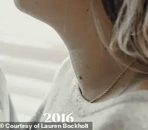 Casual TikTok Post Leads to Thyroid Diagnosis for Texas Woman