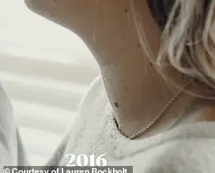 Casual TikTok Post Leads to Thyroid Diagnosis for Texas Woman