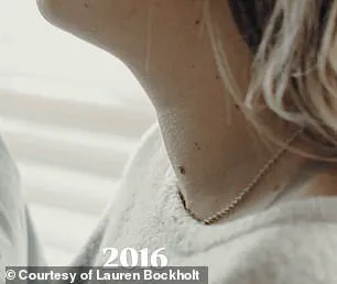 Casual TikTok Post Leads to Thyroid Diagnosis for Texas Woman